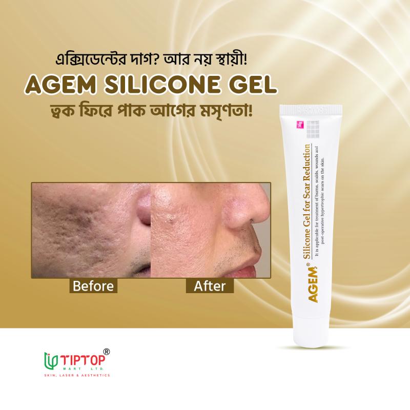 AGEM Silicone Gel 30g