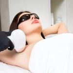 Diode Laser Underarms