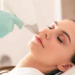 Diode Laser Upper Lips