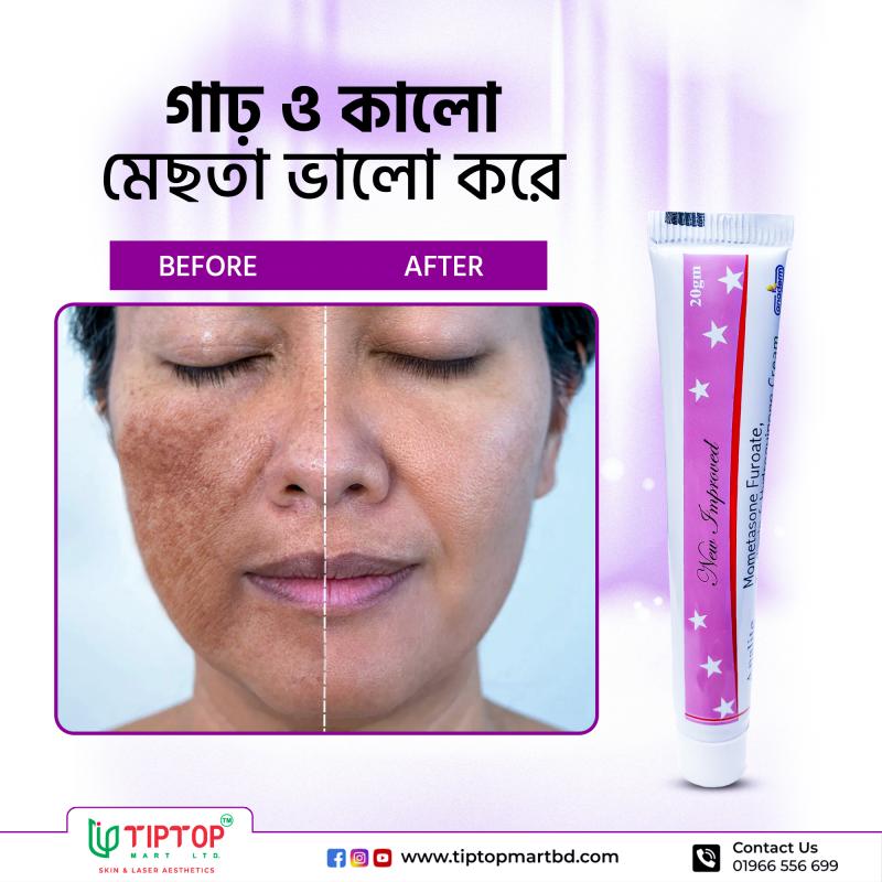 Analite Cream